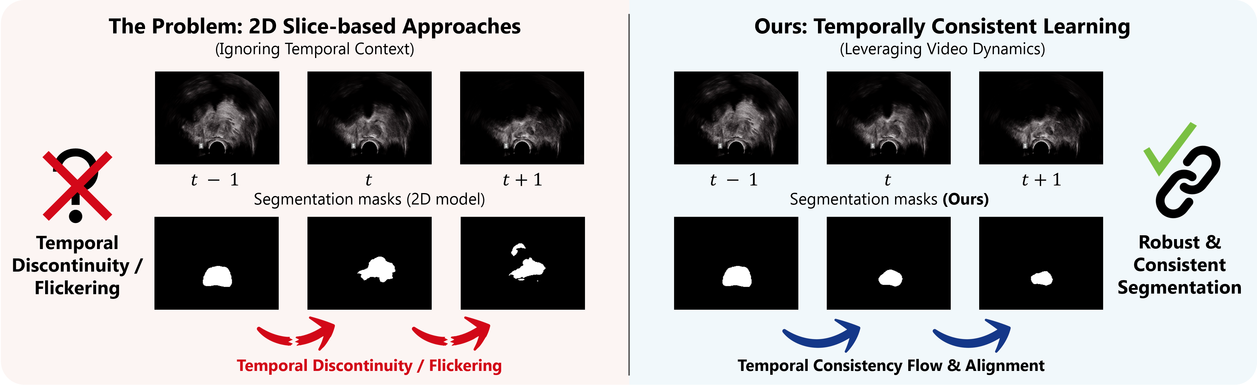 Teaser comparing flickering 2D slice-based predictions with robust temporally consistent predictions.