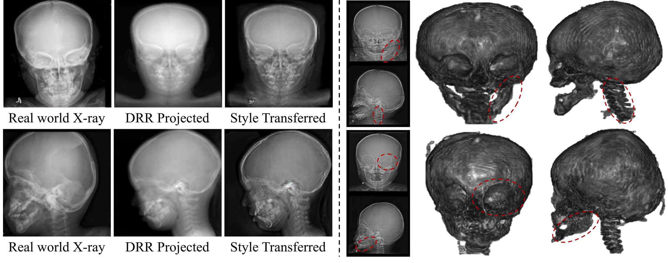Real-world X-rays, DRR projections, style-transferred X-rays, and real-world reconstructions